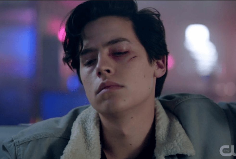 Riverdale : comment Cole Sprouse et Charles Melton se sont blessés sur le tournage