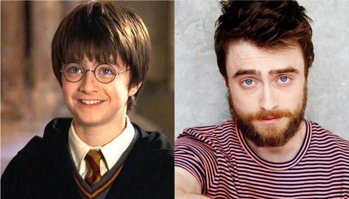 Daniel Radcliffe avant après