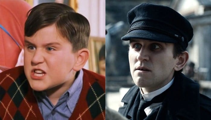 harry melling avant après