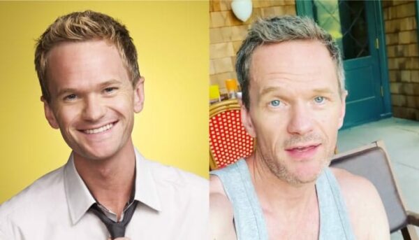 neil patrick harris avant après