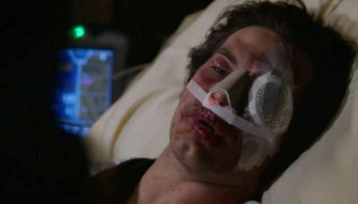 Grey's Anatomy Andrew DeLuca blessé