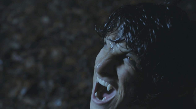 teen-wolf-la-morsure