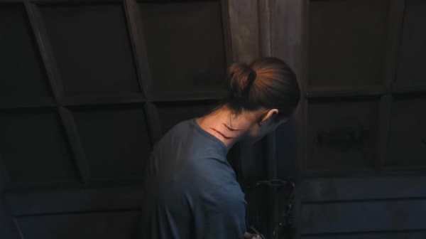 xavier-thorpe-blessure-mercredi