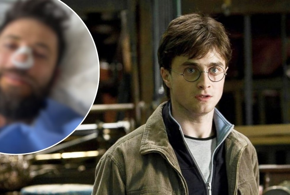 « Incapable de respirer » : où en est la santé de cette star de Harry Potter hospitalisée en urgence ?